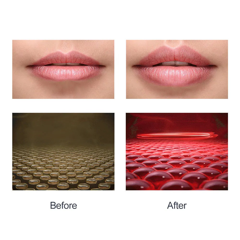 LUMABOOST Red LED Lip Plumper Device