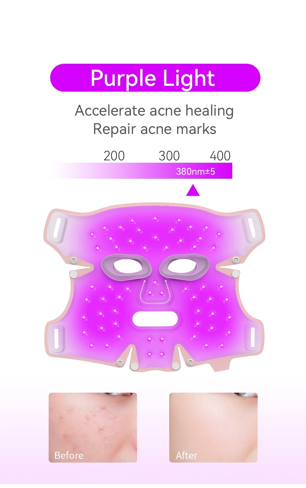 Vibrance 5 Color LED Soft Heating Rejuvenation Mask