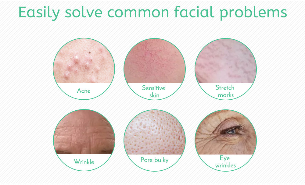 FACEGLOW Titanium Microneedle Derma Roller