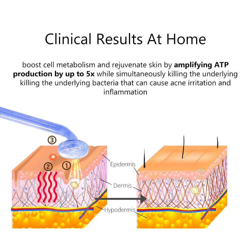 DERMAWAND FUSION