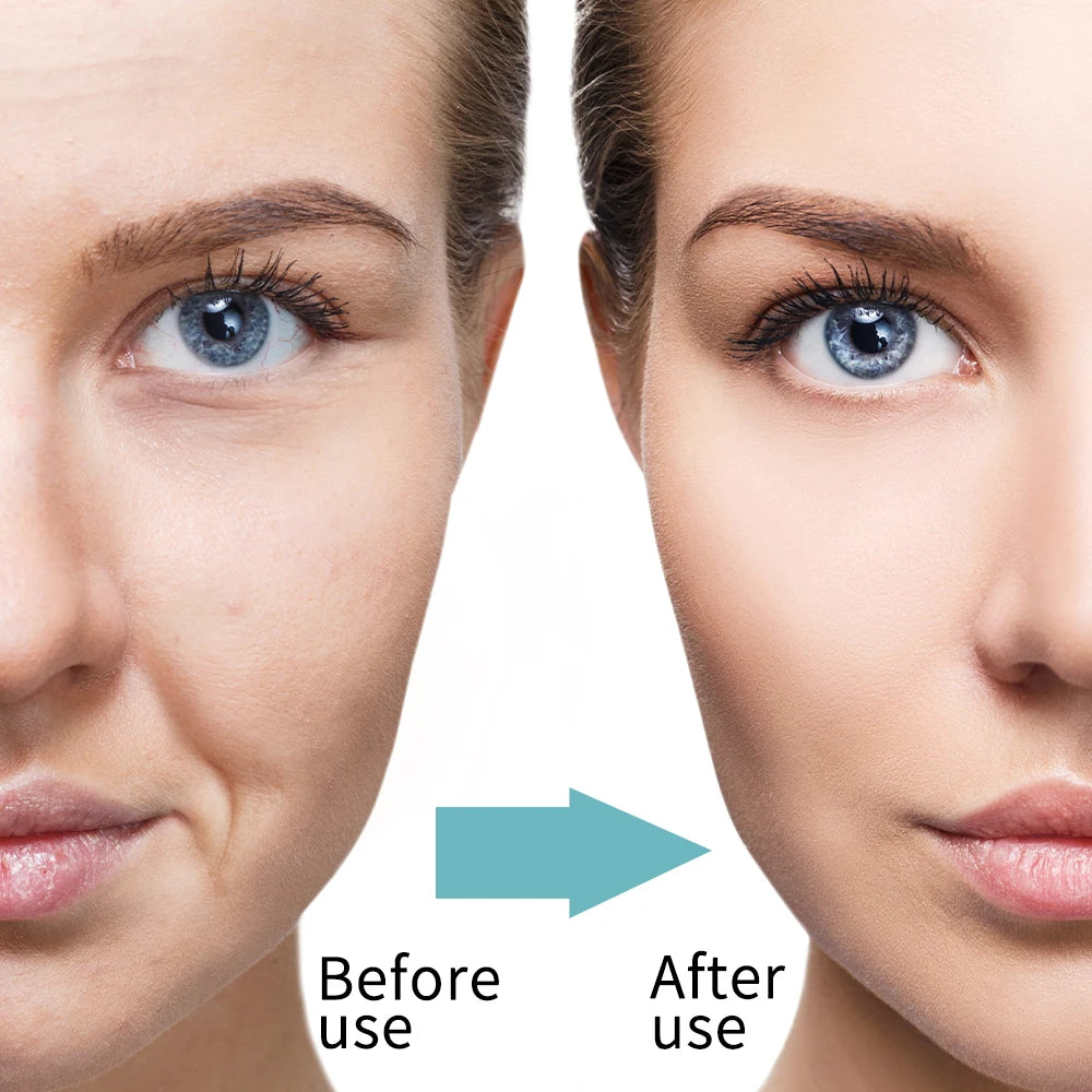 DERMAFIRM EMS Microcurrent Face Lifting Massager Band
