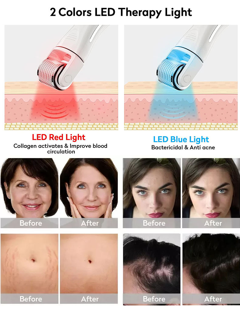SKYN BOOST LED Vibrating Microneedle Skin Rejuvenating Device