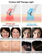 Load image into Gallery viewer, SKYN BOOST LED Vibrating Microneedle Skin Rejuvenating Device
