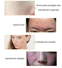 Load image into Gallery viewer, NUSKYNN PRO Smart Touch 3 Color LED Face and Neck Spa Mask
