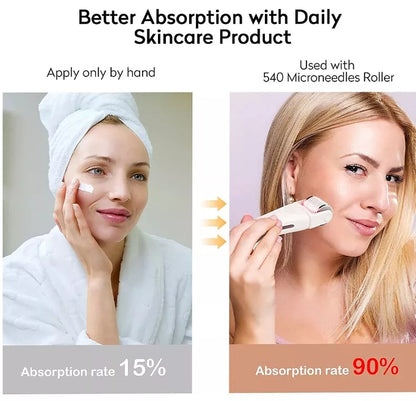 SKYN BOOST LED Vibrating Microneedle Skin Rejuvenating Device