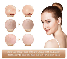 Load image into Gallery viewer, NUGLOW GOLD Smart Touch 7 Color LED Spa Mask
