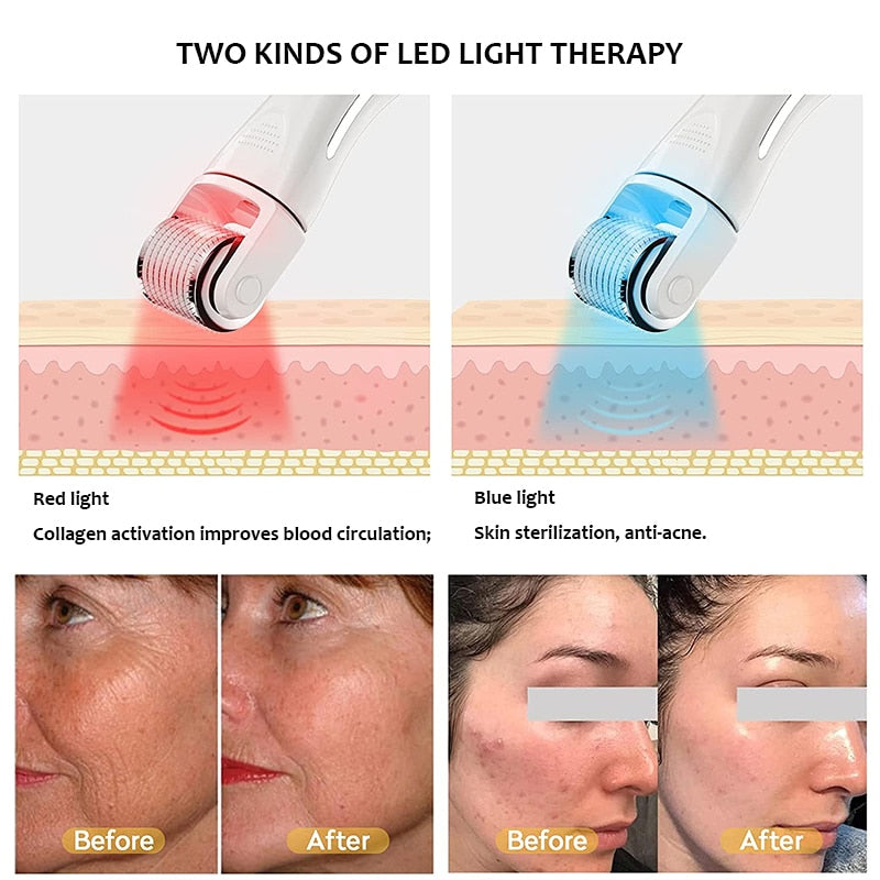 SKYN BOOST LED Vibrating Microneedle Skin Rejuvenating Device