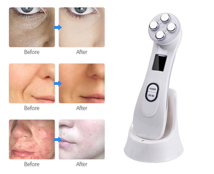 REMI Face Lifting LED Device