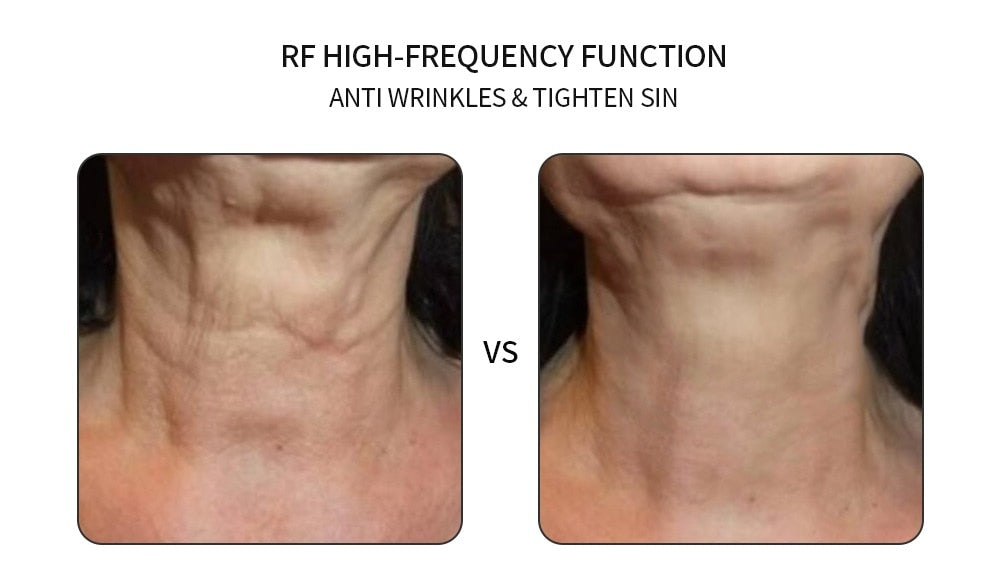 REMI Face Lifting LED Device