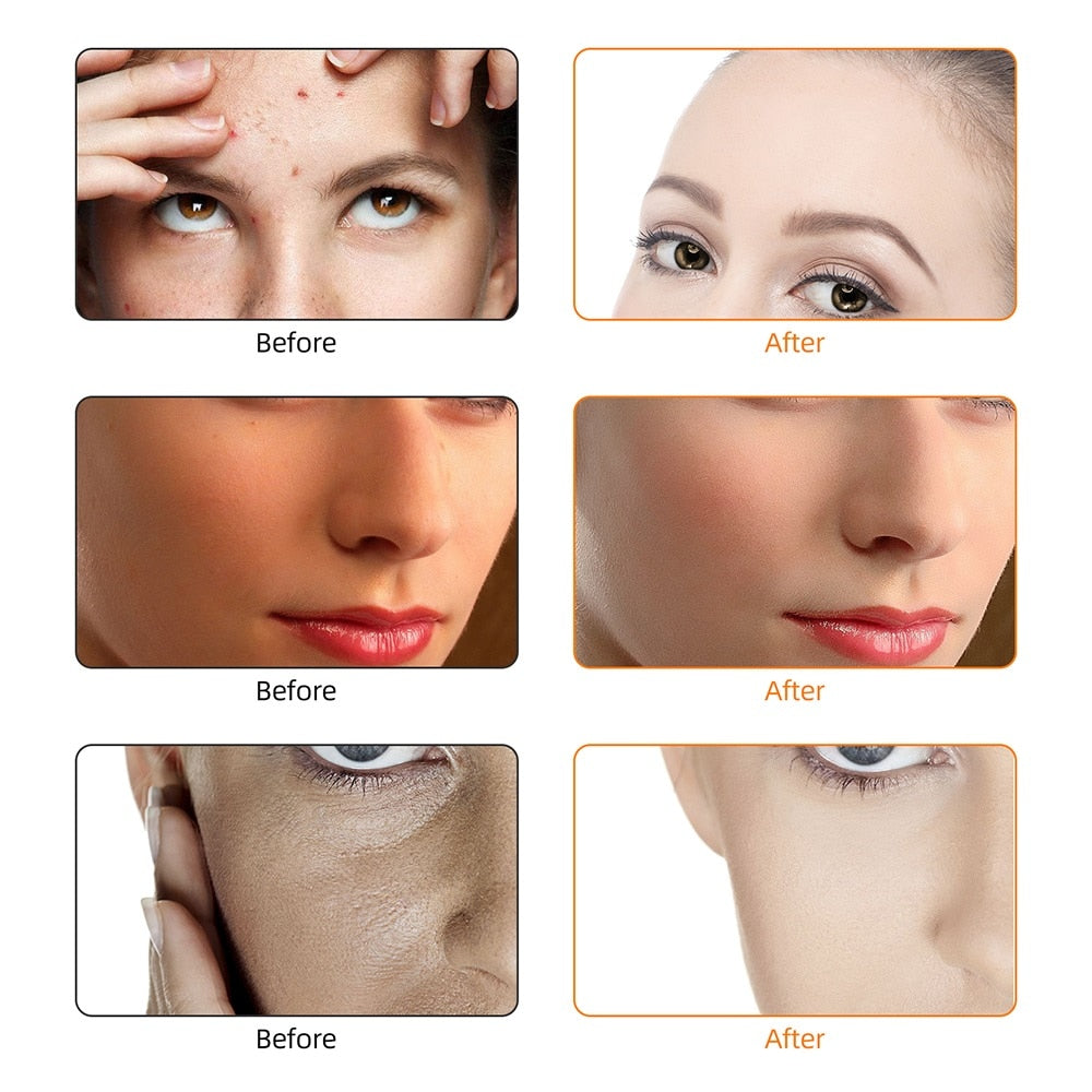LITEGLOW 3 Color LED Rejuvenating Facial Mask