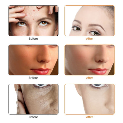 LITEGLOW 3 Color LED Rejuvenating Facial Mask