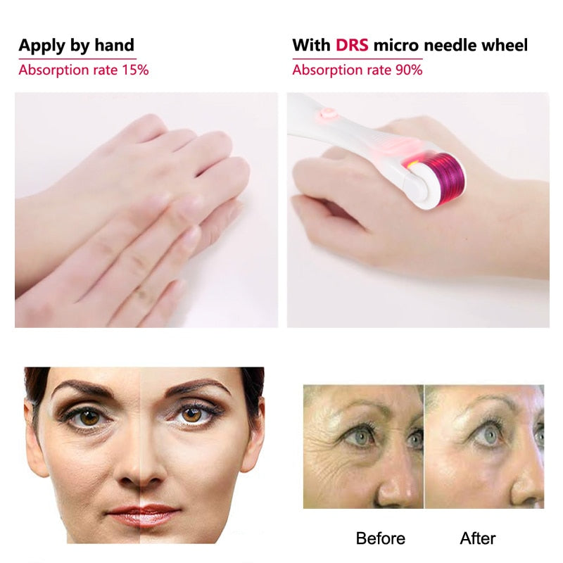 PROGLOW Electric LED Microneedle Derma Roller