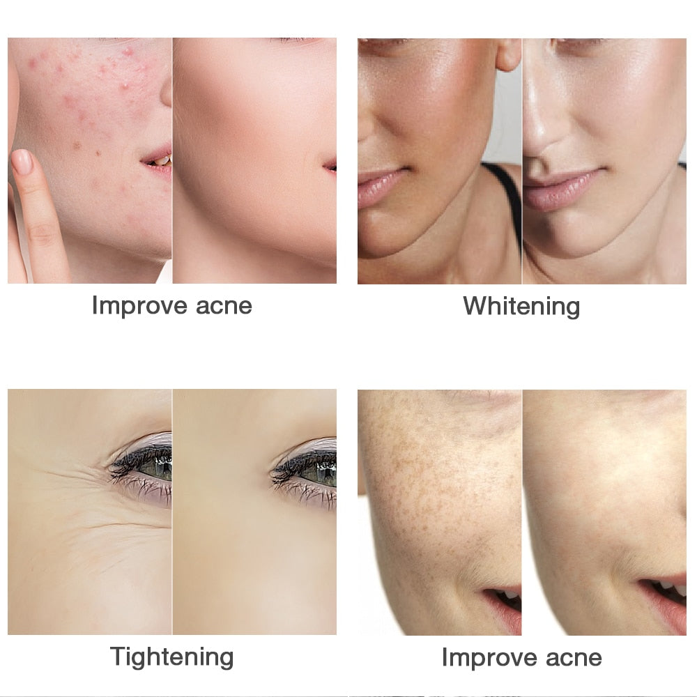 LITEGLOW 7 Colors LED Rejuvenation Face Mask