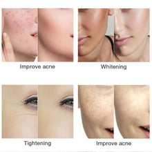 Load image into Gallery viewer, LITEGLOW 7 Colors LED Rejuvenation Face Mask
