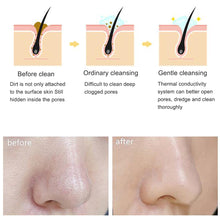 Load image into Gallery viewer, GLOWY Silicone Facial Cleansing Brush
