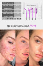 Load image into Gallery viewer, DERMAWAND - NO BLEMISH (Argon)
