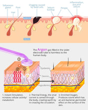 Load image into Gallery viewer, DERMAWAND - NO BLEMISH (Argon)
