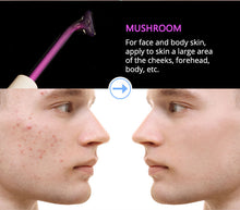 Load image into Gallery viewer, DERMAWAND - NO BLEMISH (Argon)
