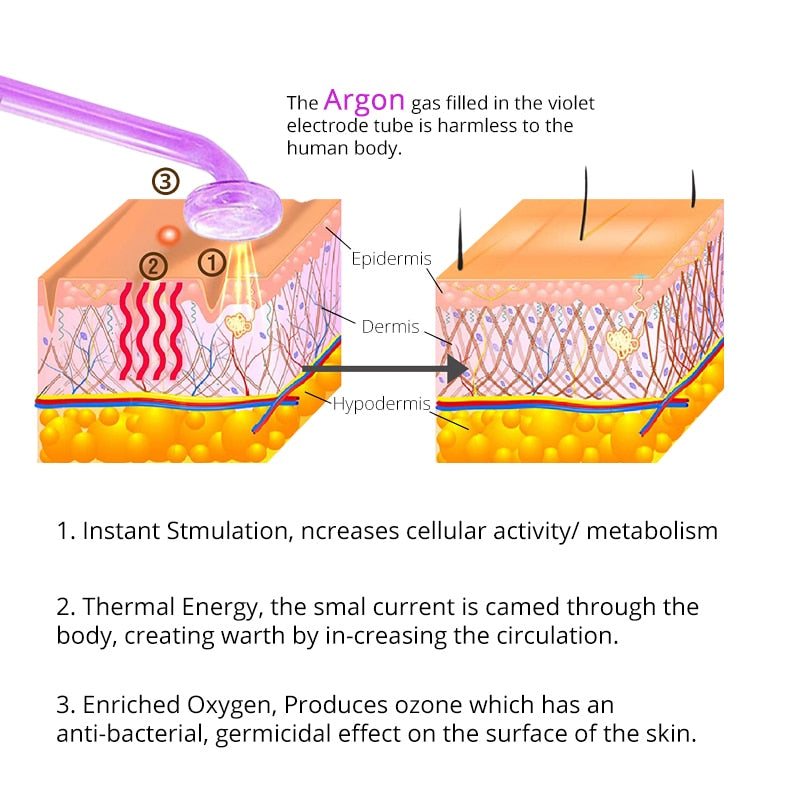 DERMAWAND - NO BLEMISH (Argon)