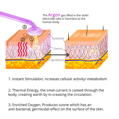 DERMAWAND - NO BLEMISH (Argon)