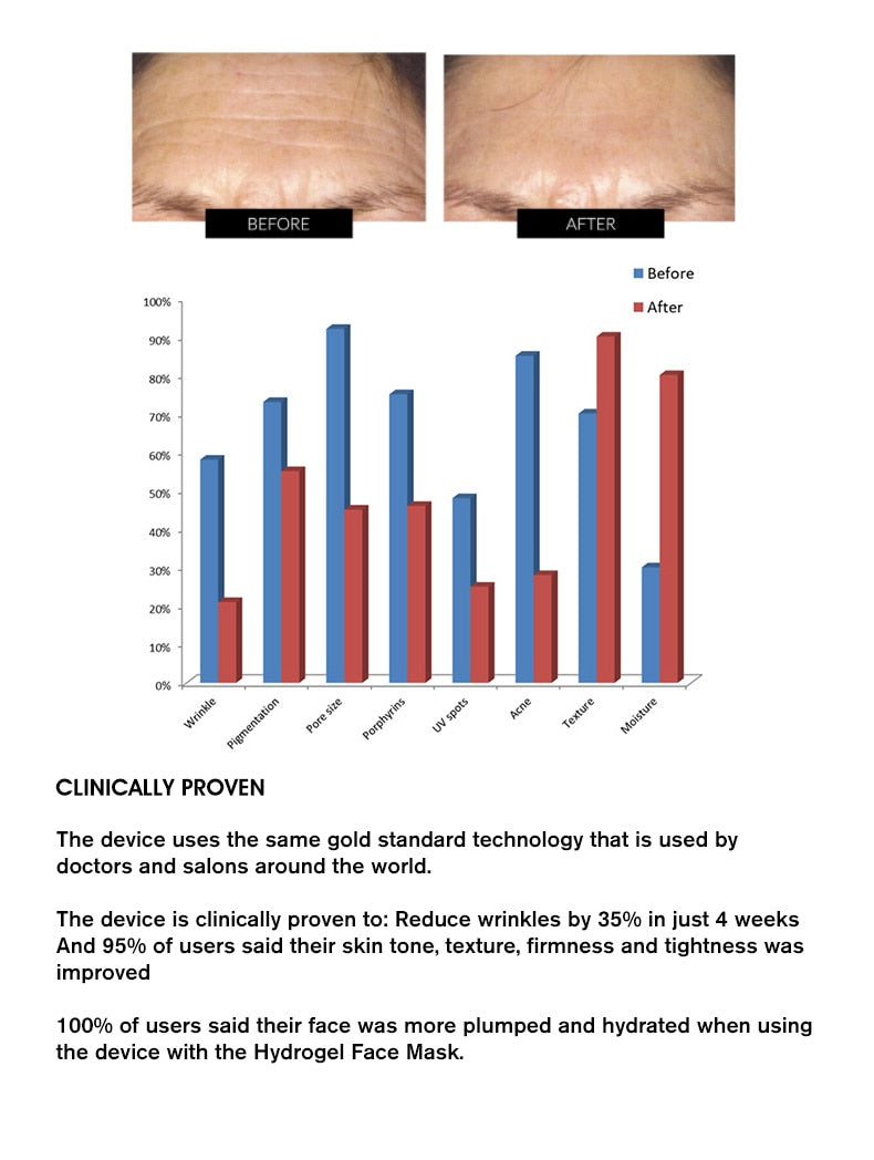 SO GLOW! Silicone LED Rejuvenating Mask