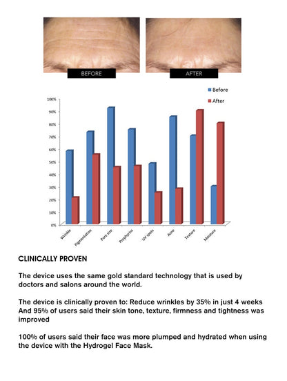 SO GLOW! Silicone LED Rejuvenating Mask