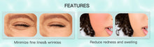 Load image into Gallery viewer, CRYOGLO Face Lifting Massager
