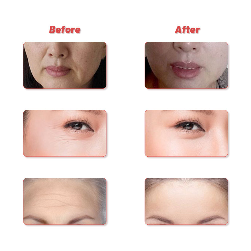 SCULPT Vibration Massage Beauty T Bar